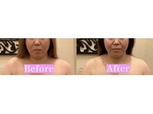 アジール 長岡リバーサイド千秋店(agir)/before/after画像
