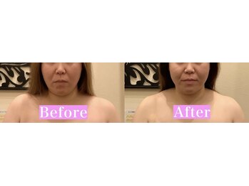 アジール 長岡リバーサイド千秋店(agir)/before/after画像