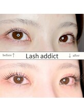 ユイ(YUI)/パリジェンヌラッシュリフト