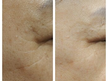 レディラックビューティー 横浜(Lady Luck beauty)/ララピール★横浜/みなとみらい