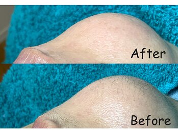 夏秋美肌サロン/毛穴洗浄+フェイシャルワックス