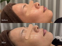 アウラ 小杉店(AULA)/