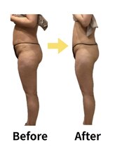 ムーロ(muro.)/BeforeAfter