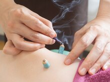 祥凰堂鍼灸治療院/お灸