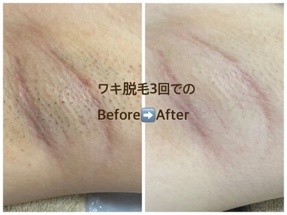 リゲルス(Regel)の写真