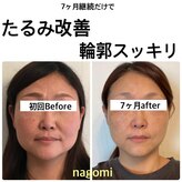 ナゴミ(NAGOMI)