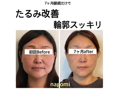 ナゴミ(NAGOMI)の写真