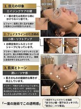 ミヨン ヨコハマ(Miyonne Yokohama)/ホワイトスノーピール×LDMAqua