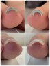 【半額!10名限定】巻き爪・陥入爪・変形爪・肥厚爪ケア