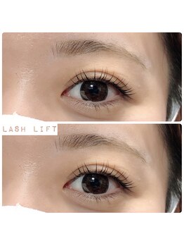 ノエラ(Noela)/ラッシュリフト