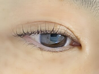 アリクシア(Alyxia)/