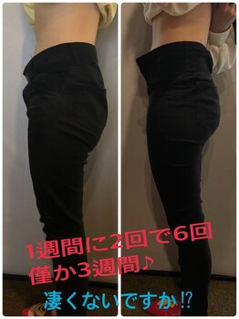 ビオナス(BIONAZ)/磁場エネルギーってホントに凄い