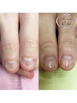 ネイルサロン キュービット(Q-bit)/