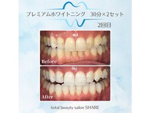 シェア(SHARE)の雰囲気（刺激0なのにしっかり艶々な白さ！終わった後はすぐ飲食・喫煙OK）