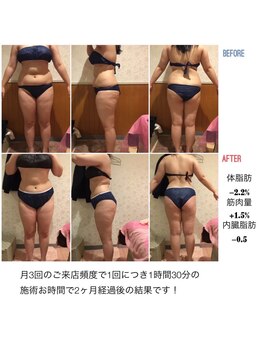 アンリール 苫小牧店(ANRIRE)/ボディー施術のお客様です