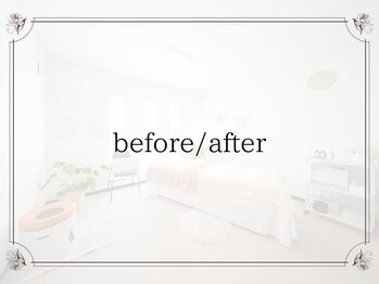 ミリアージュ(Miliage)/before / after