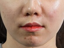 レディラックビューティー 横浜(Lady Luck beauty)/ララピール★横浜/みなとみらい