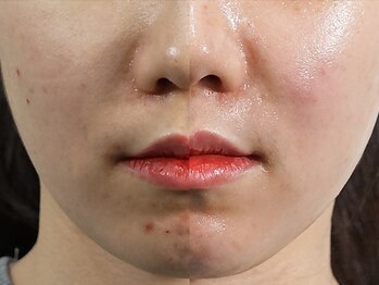 レディラックビューティー 横浜(Lady Luck beauty)/ララピール★横浜/みなとみらい