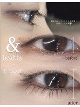 ステイゴールド(STAY GOLD)/下まつげアンドヘルシー