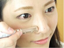 エステサロン ロゼッタ(ROSETTA)/気になる鼻の黒ずみ、毛穴を吸引