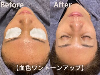 グレース 吉祥寺(grace)/肌が滑らかにトーンアップ