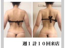 ウィズルーチェ つくばみどりの店(with luce)の雰囲気（上半身集中60分コース10回2ヶ月【20代ブライダル】）