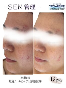 レピア(Le'pia)/トロイアルケ|SEN管理