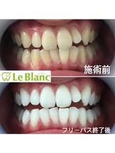 ルブラン 奈良店(Le Blanc)/印象良く！！