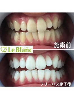 ルブラン 奈良店(Le Blanc)/印象良く！！