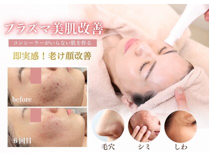 ヴィアス(VIAS)の写真