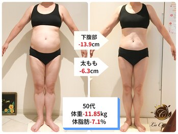 ラ コンシェル 町田店/Before After【町田店】