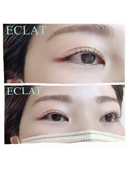 エクラ(ECLAT)/addictカール