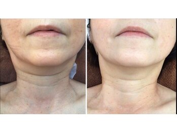 クレビア 神保町 水道橋(CREBIA)/フェイシャル/痩身サロン