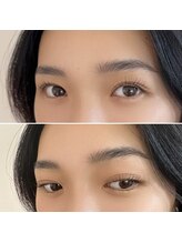 ラウラ(LAULA)/似合わせラッシュリフト