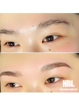 ヴィータ(VITA)/ブライダル前にも