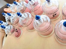 リウム(Lium)/カッピング【背中】