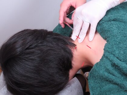 ソフトリーの写真