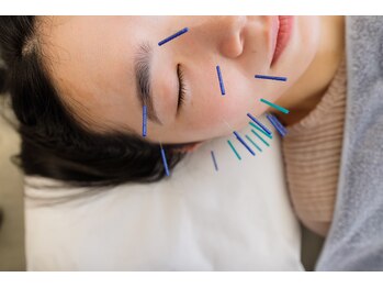 ハリカ 神戸三宮(harica)/美容鍼