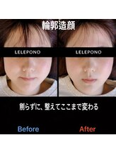 美容矯正サロン レレポノ(LELEPONO)/