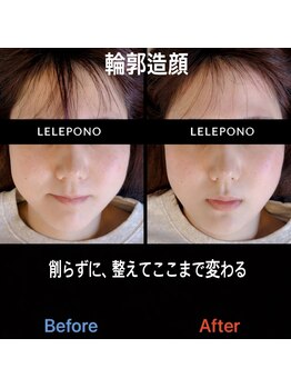 美容矯正サロン レレポノ(LELEPONO)/