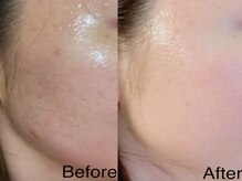 シャルトルズ 広島八丁堀店の雰囲気（終わりのあるケアをご提案。原因から改善へ導きます）