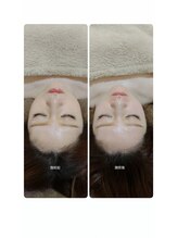 吉川美南ライフ整骨院/30代女性