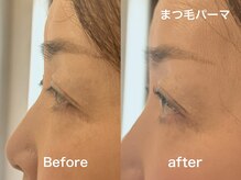 ライラック 二子玉川(Lilac)/まつげパーマ　まつ毛パーマ