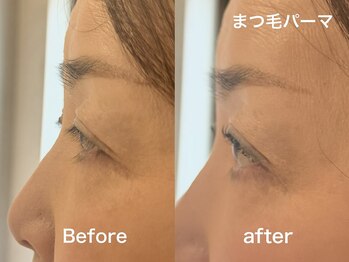 ライラック 二子玉川(Lilac)/まつげパーマ まつ毛パーマ