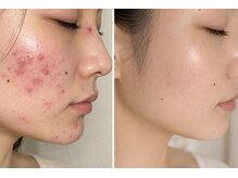 スパエスター 銀座本店(SPA Esther)/ビフォーアフター