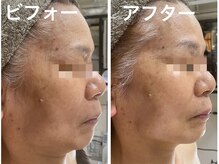 ナオフクオカ ヒーリングフォースエヌ(NaoFukuoka/healingforceN)/立体的なお顔作りならhealingへ