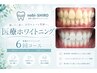 【学割U24限定】医療提携セルフホワイトニング6回|学生応援価格