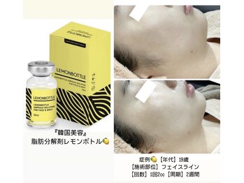 エステティックサロン さらの写真/もたつきやたるみ、二重アゴが気になる方へ。『小顔レモンボトル』でほうれい線を整えよう◎
