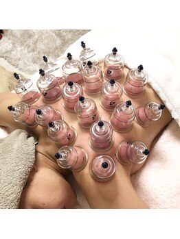 アンジュブリアン(Ange brillant)/カッピングで凝りスッキリ