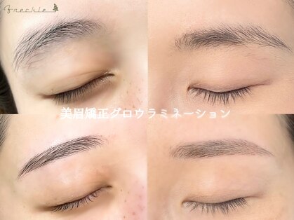 フレックル(freckle)の写真